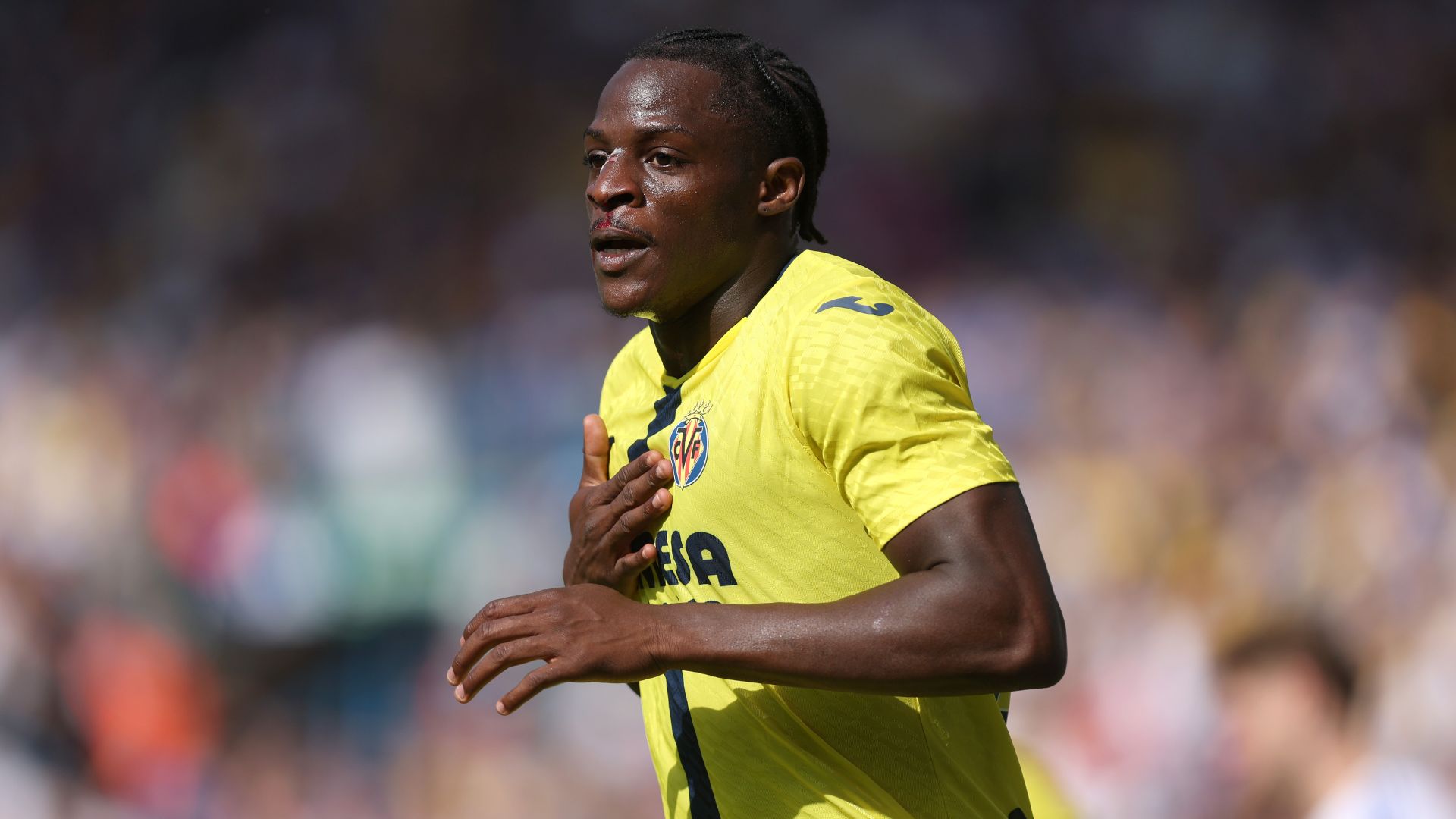 LEEDS, ENGLAND - AUGUST 02: Etta Eyong of Villarreal CF celebrates scoring his team's first goal during the pre-season friendly match between Leeds United and Villarreal CF at Elland Road on August 02, 2025 in Leeds, England.